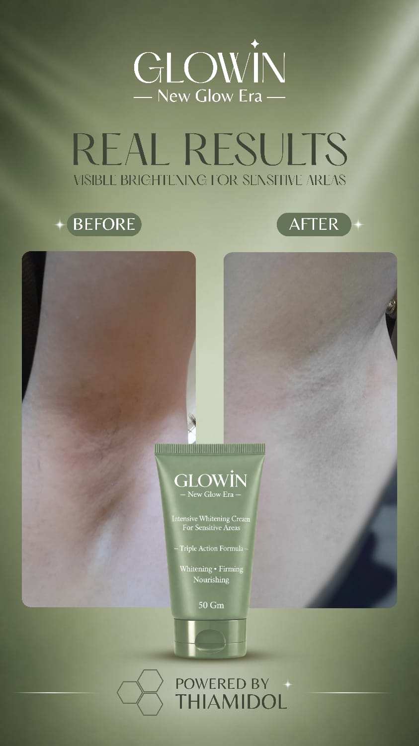 Customer result image