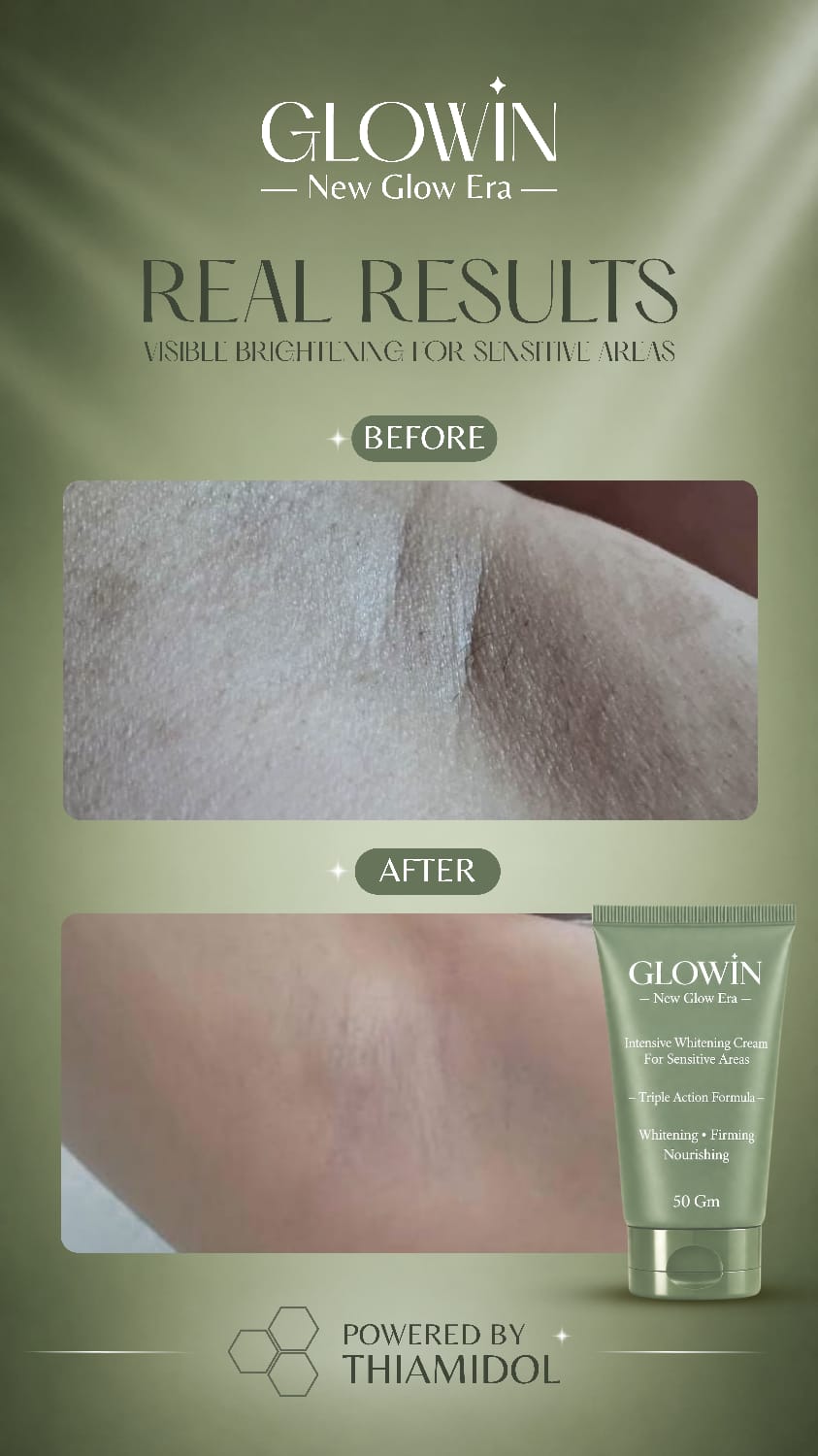 Customer result image