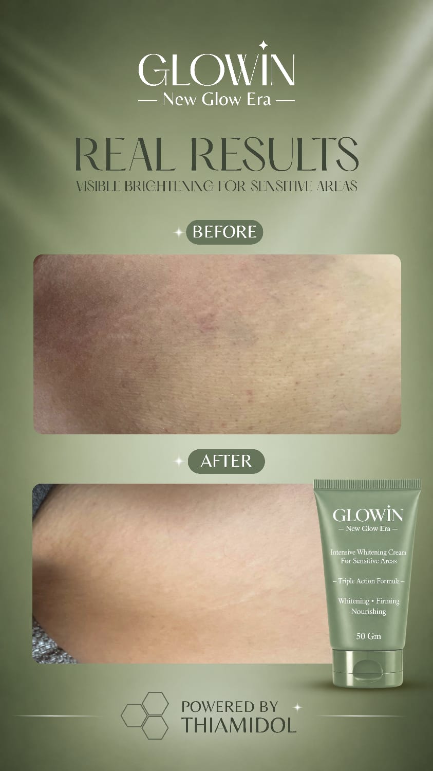 Customer result image