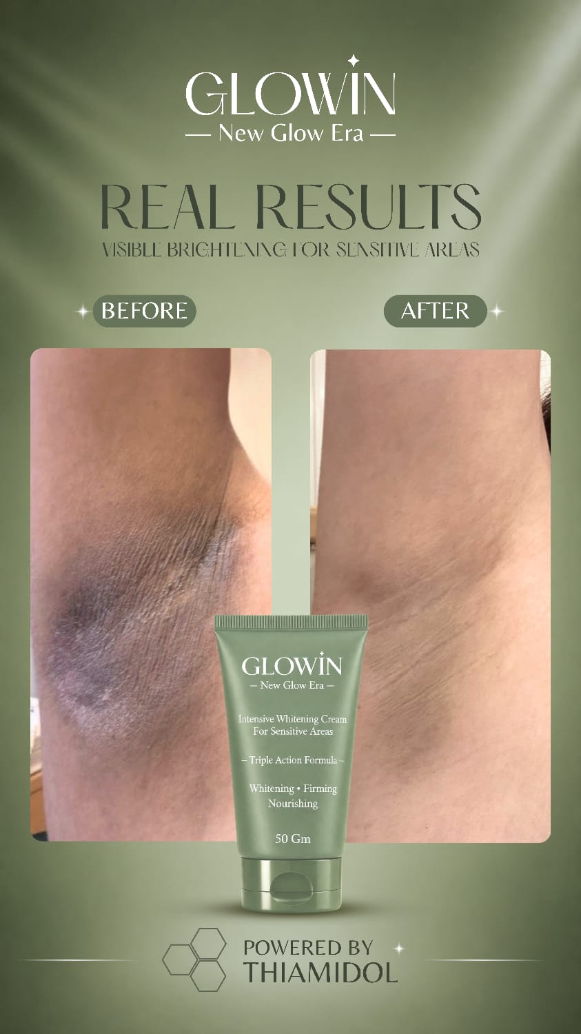 Customer result image