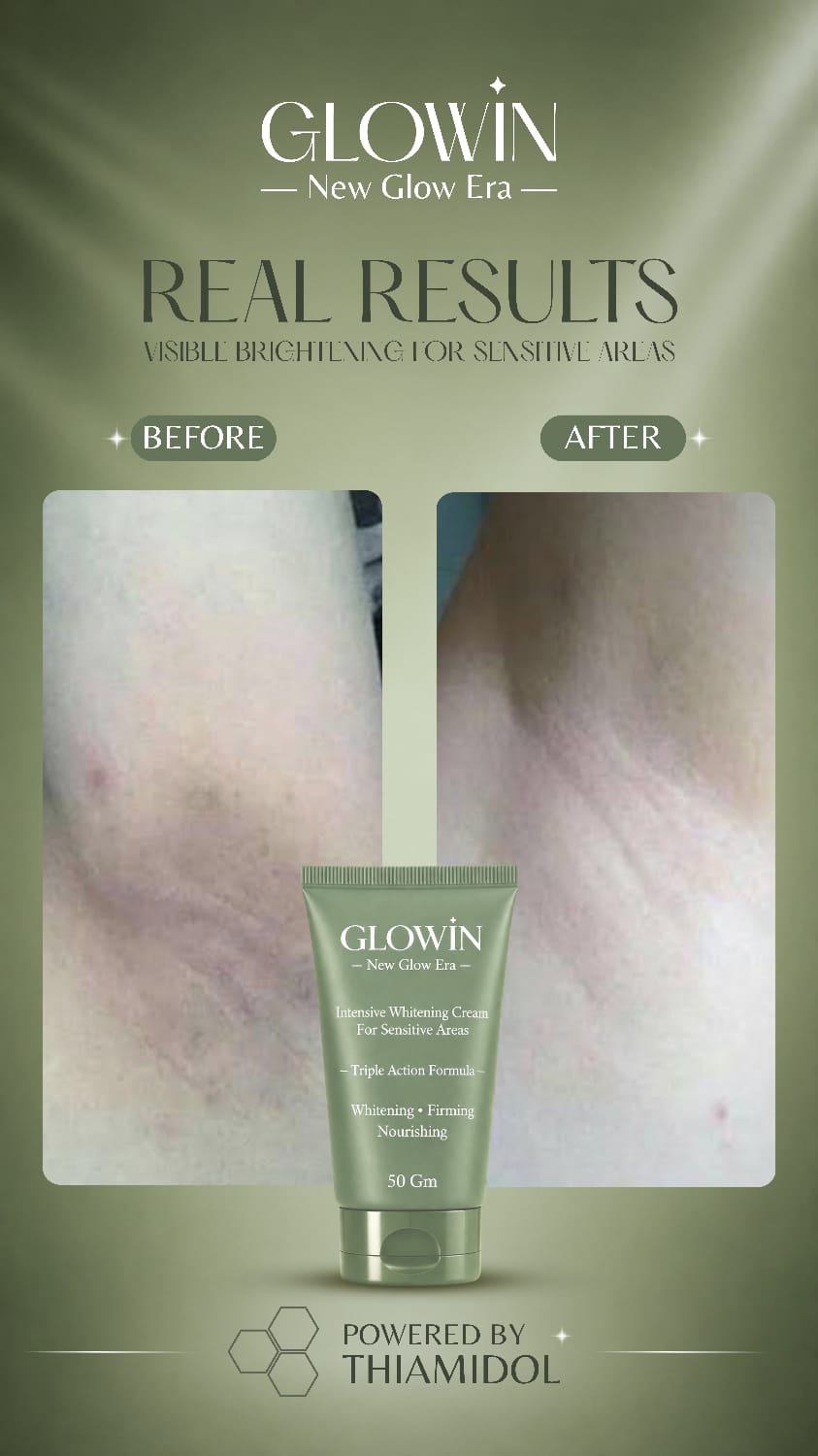 Customer result image