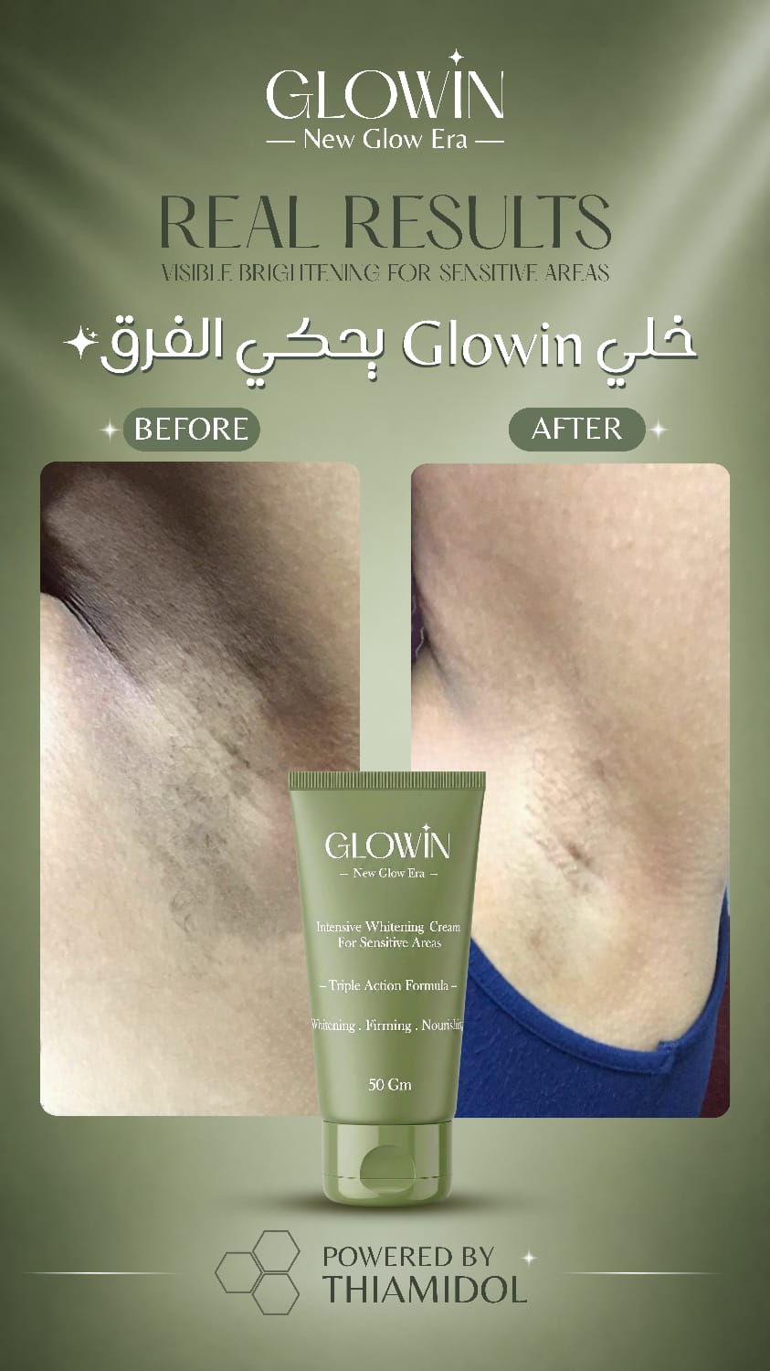 Customer result image
